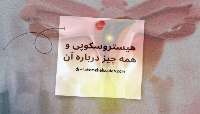 هیستروسکوپی چیست؟