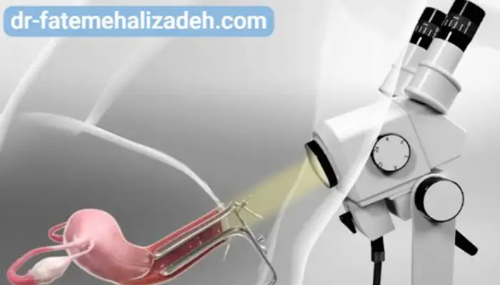 کولپوسکوپی