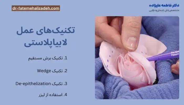 تکنیک های عمل لابیاپلاستی