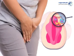 تصویر خانمی که دستش را روی ناحیه تناسلی گذاشته همراه با نمودار آناتومیک نشاندهنده عفونت