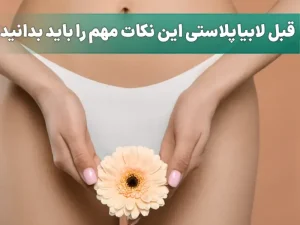 اقدامات قبل از لابیاپلاستی