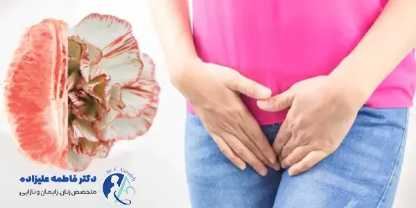 روشهای درمان ورم بعد از لابیاپلاستی