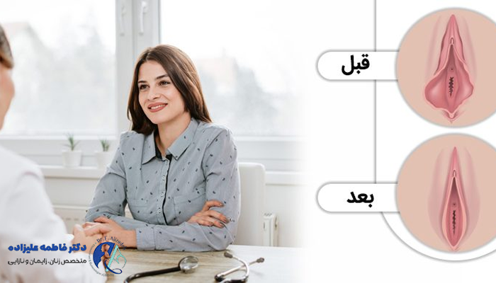 مشاوره پزشکی و نتایج قبل/بعد از عمل زنان