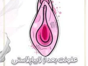 ورم بعد از لابیاپلاستی