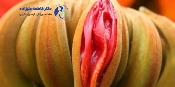 تفاوت واژینوپلاستی و لابیاپلاستی