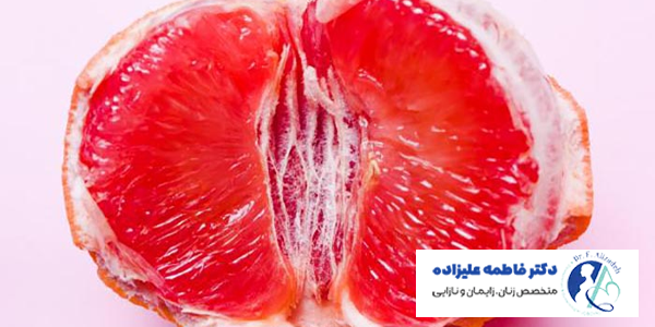 مراقبت های قبل عمل واژینوپلاستی