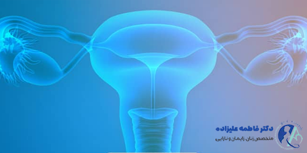 تفاوت فیبروم و کیست تخمدان