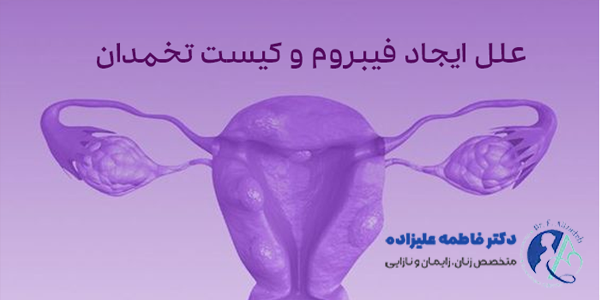 تفاوت فیبروم و کیست تخمدان