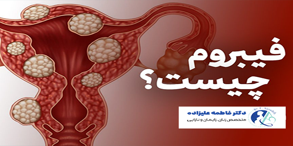 فیبروم رحم