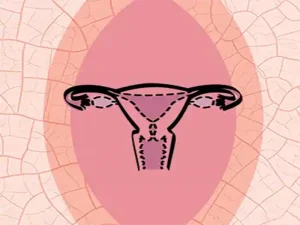 خشکی واژن در زنان